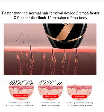 Beauty laser hair removal